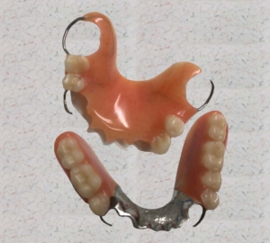 Partial upper and lower dentures