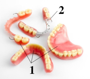 Pink acrylic base of different types of dentures: (1) full dentures and an acrylic partial denture, and (2) a cast metal denture
