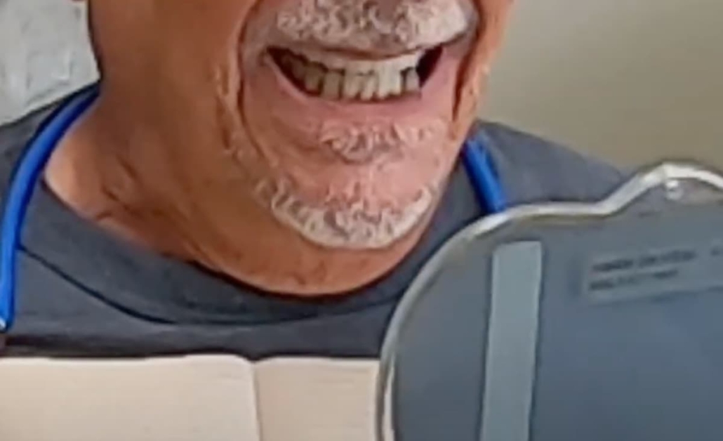Closeup of man using a handheld mirror to check his new full upper and partial lower dentures, still in wax if he wants to make any changes