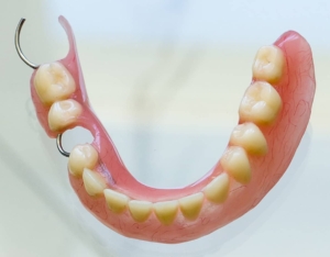 A Partial Lower Acrylic Denture with all artificial teeth except a couple of back molar teeth and metal clasps to hook onto your 2 natural teeth to hold it in