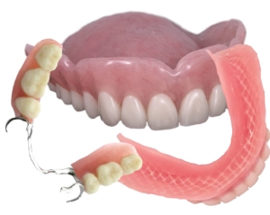 Showing the underside of a full upper and full lower denture, the part that goes against the upper palate and lower tissues, and a partial cast lower denture with its clasps